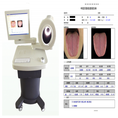 中醫(yī)舌診圖像分析系統(tǒng)（臺(tái)車式）